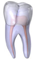 Craze lines - these are tiny cracks that only affect the outer enamel of the tooth.. Fractured Cusp - when a cusp becomes weakened, a fracture may result.